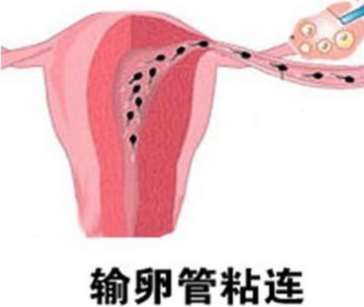 南京哪有助孕-杭州助孕包生儿子